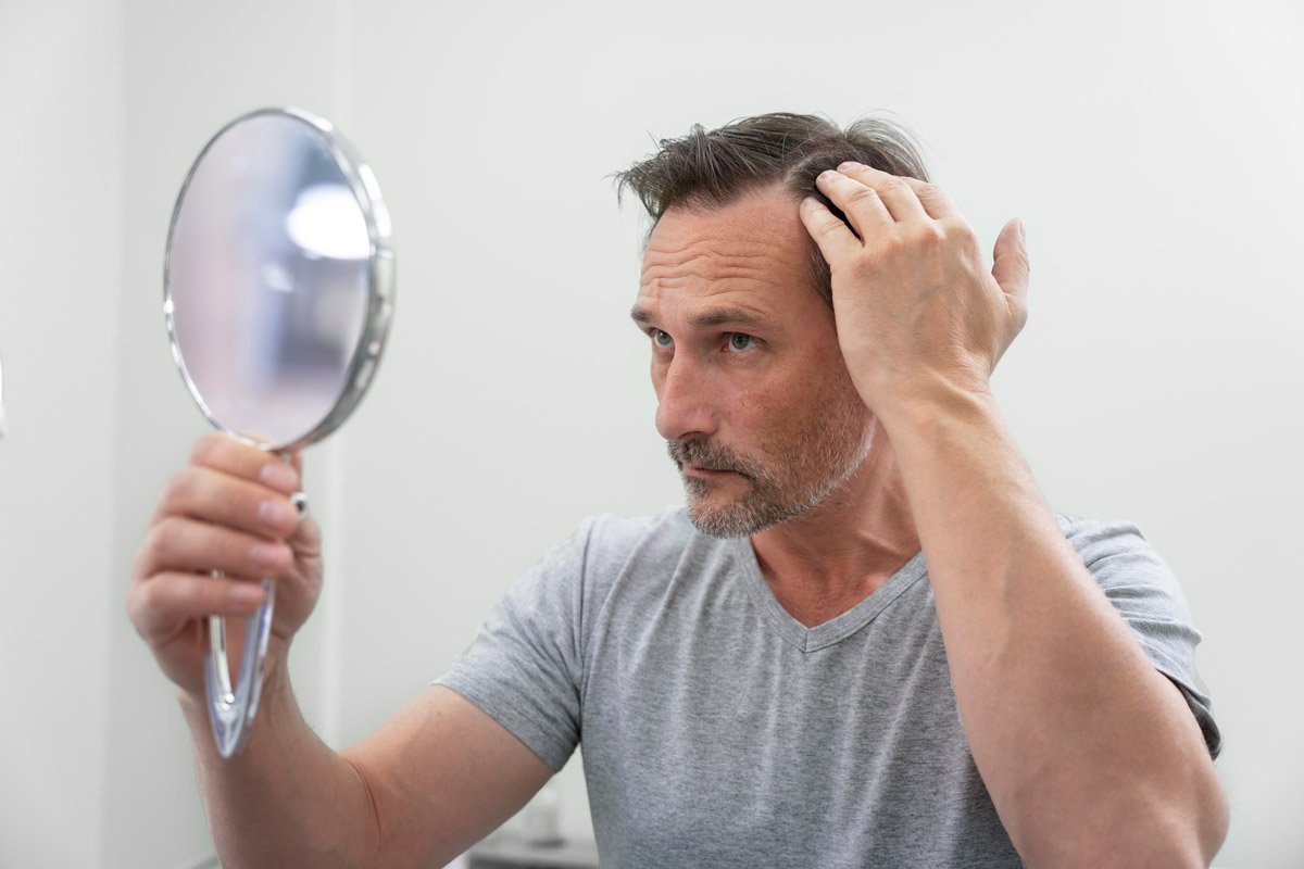 quanto durano i capelli trapiantati