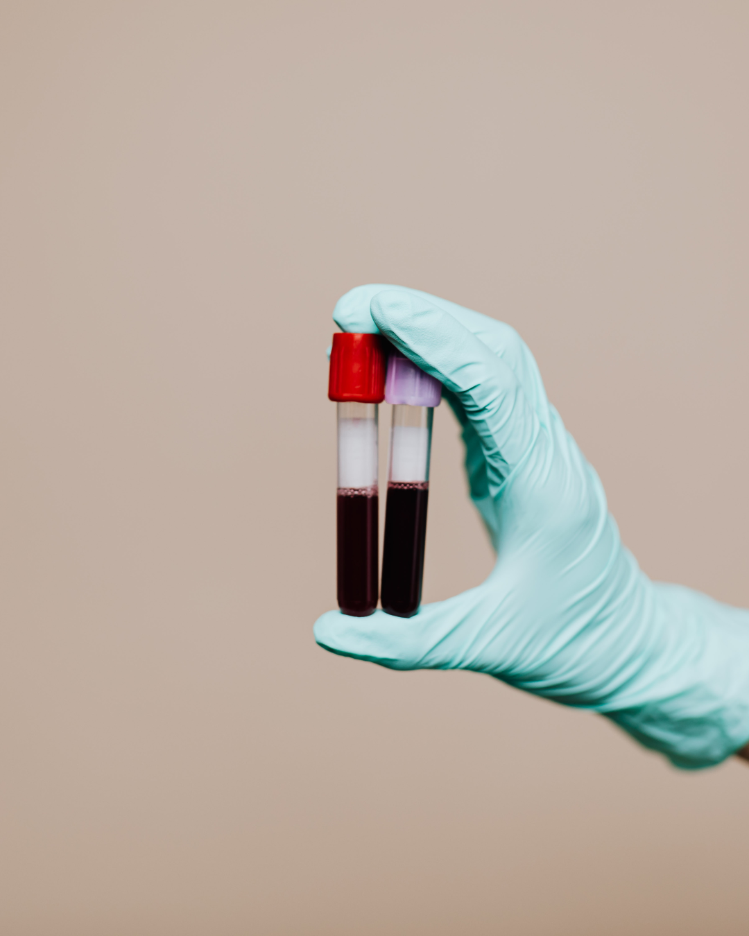 fialette di sangue